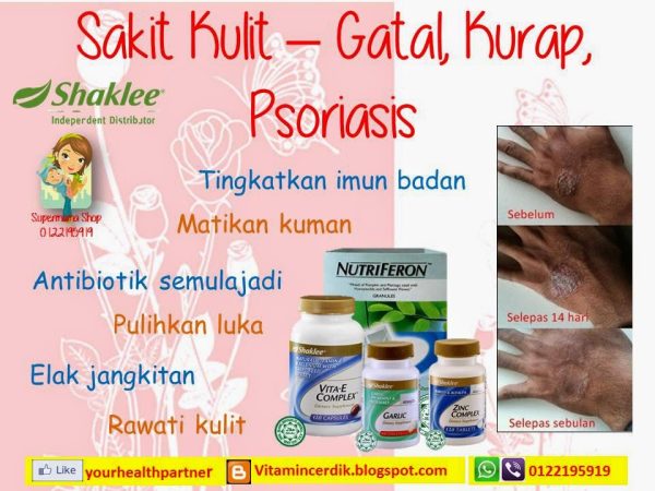 Cara Hilangkan Kulit Gatal